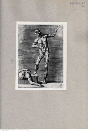 Vorderseite von  [http://creativecommons.org/publicdomain/mark/1.0/] Anatomische Darstellung eines Mannes mit geöffnetem Bauch - , bh092465. Foto.